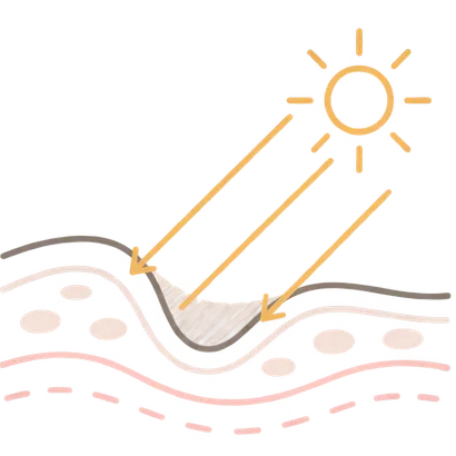 肌イラスト