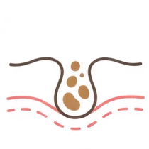 肌イラスト