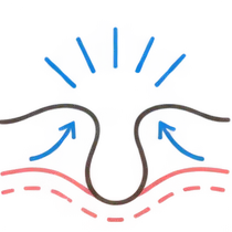 肌イラスト