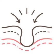 肌イラスト