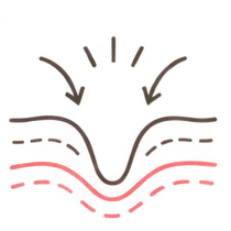 肌イラスト